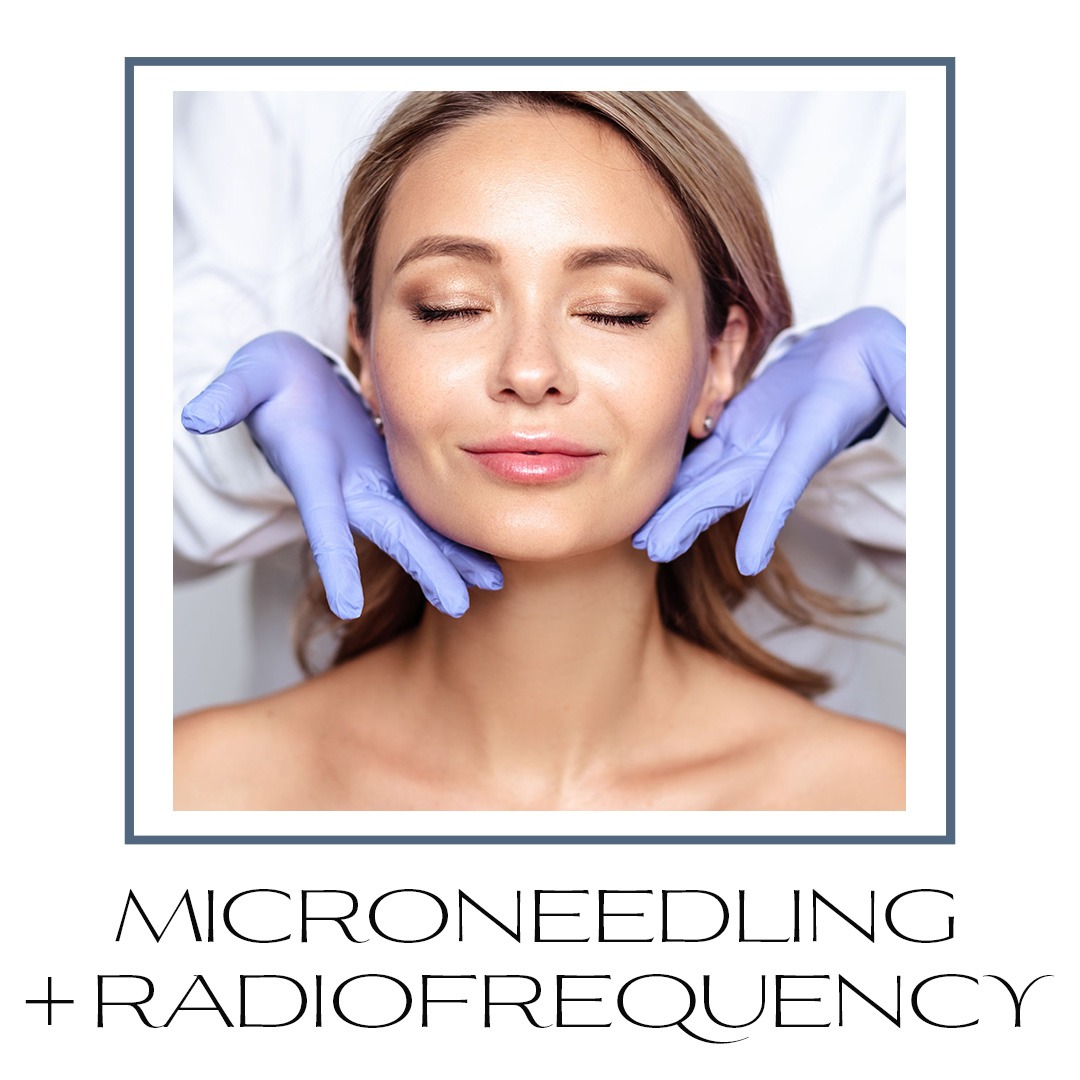 Microneedling plus radiofrequency skin treatments