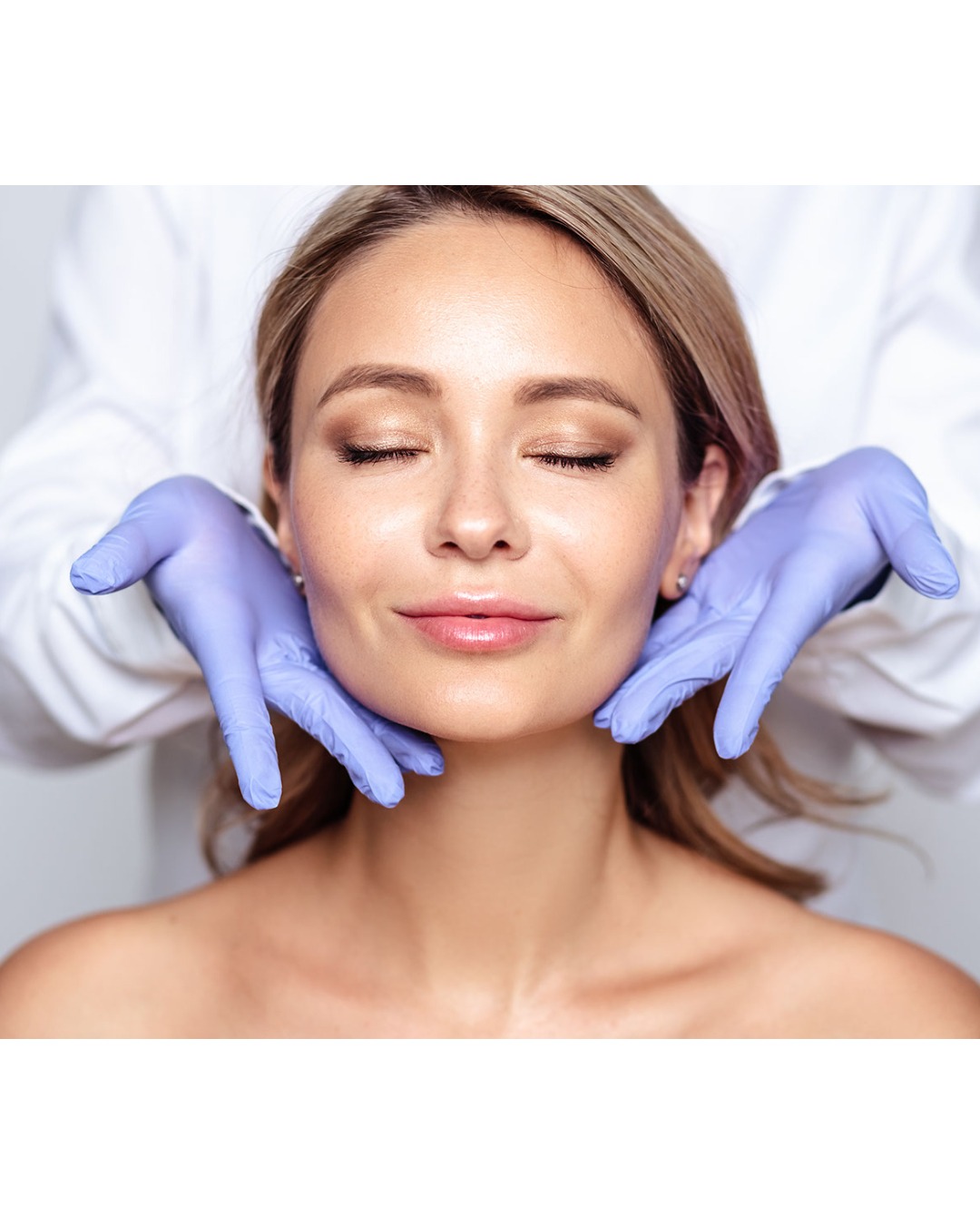 microneedling with radiofrequency
