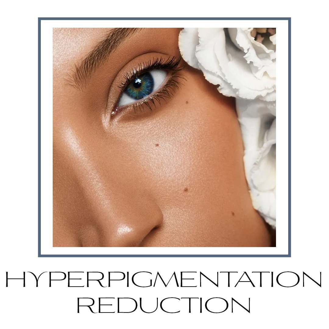hyperpigmentation reduction