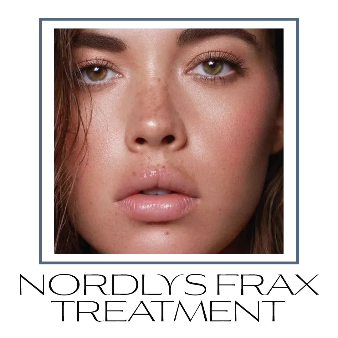 nordlys frax treatment