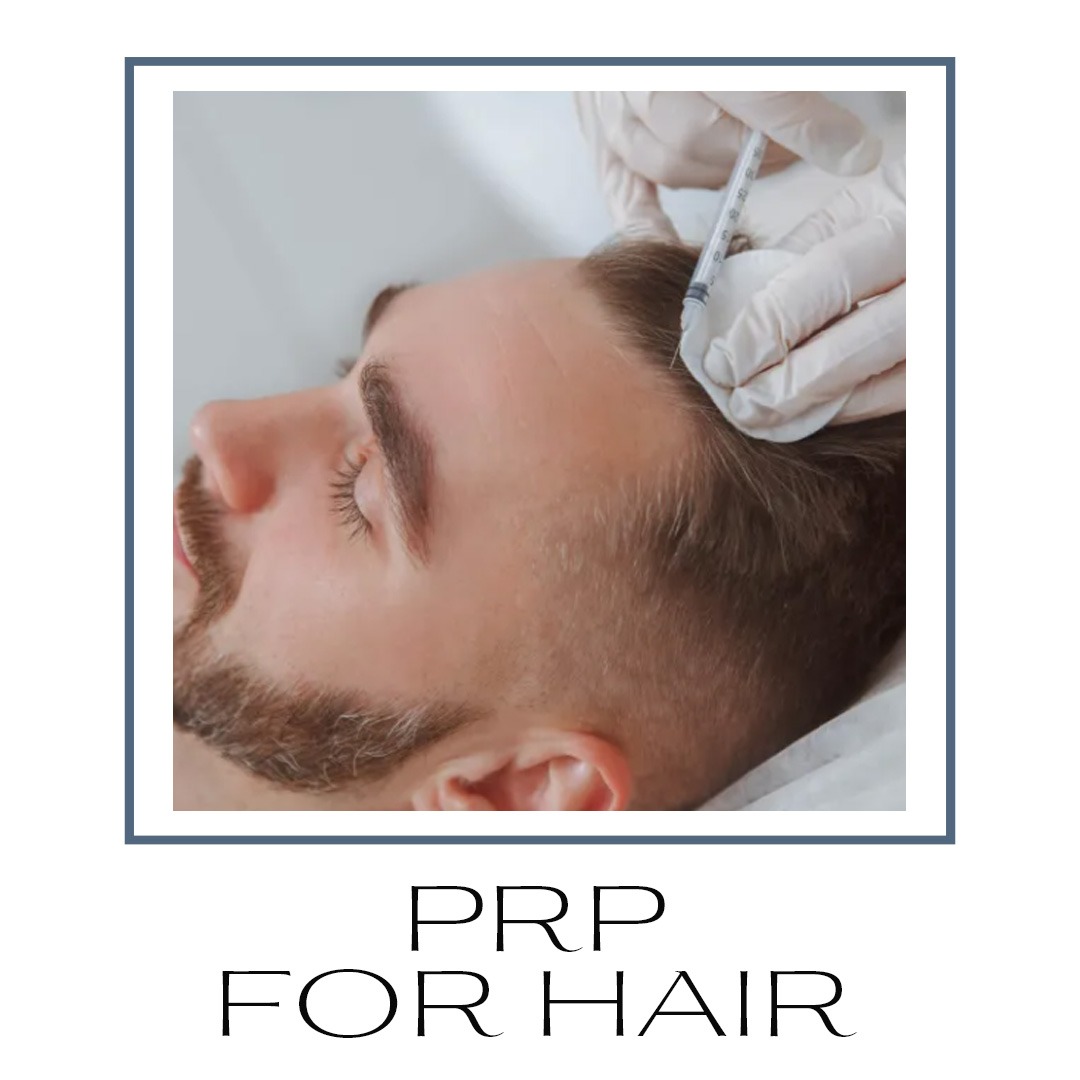 PRP for hair