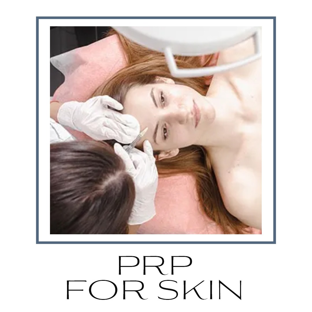 prp skin treatments